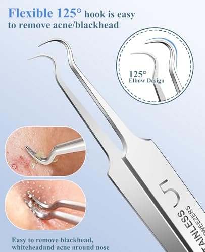 3-Piece Blackhead Remover Tweezers & Pimple Popper Tool Kit – Stainless Steel Extractor for Blemishes, Whiteheads, and Ingrown Hairs Avelisse