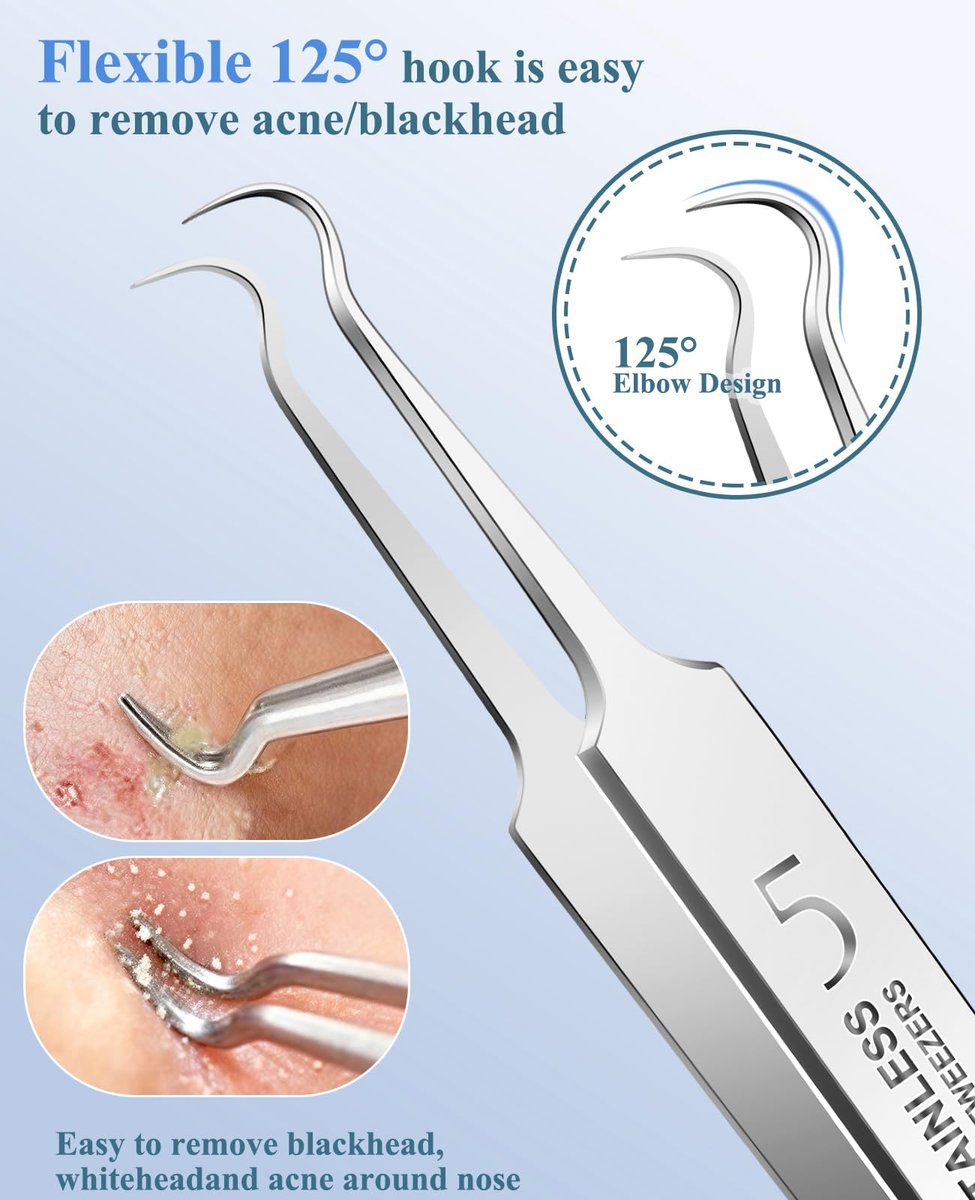 3-Piece Blackhead Remover Tweezers & Pimple Popper Tool Kit – Stainless Steel Extractor for Blemishes, Whiteheads, and Ingrown Hairs Avelisse