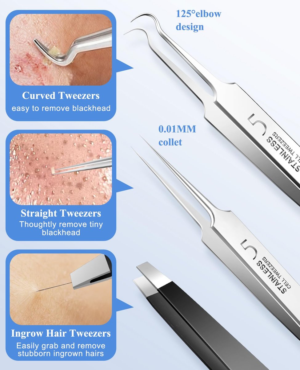 3-Piece Blackhead Remover Tweezers & Pimple Popper Tool Kit – Stainless Steel Extractor for Blemishes, Whiteheads, and Ingrown Hairs Avelisse