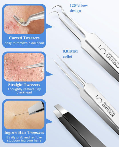 3-Piece Blackhead Remover Tweezers & Pimple Popper Tool Kit – Stainless Steel Extractor for Blemishes, Whiteheads, and Ingrown Hairs Avelisse