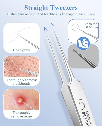 3-Piece Blackhead Remover Tweezers & Pimple Popper Tool Kit – Stainless Steel Extractor for Blemishes, Whiteheads, and Ingrown Hairs Avelisse