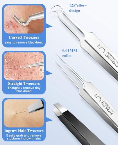 3-Piece Blackhead Remover Tweezers & Pimple Popper Tool Kit – Stainless Steel Extractor for Blemishes, Whiteheads, and Ingrown Hairs Avelisse