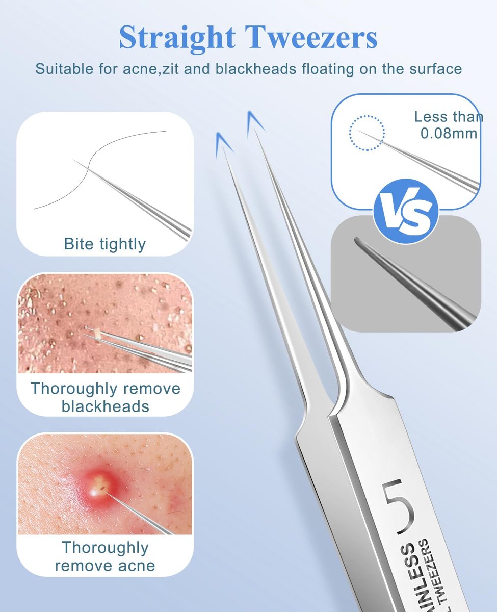 3-Piece Blackhead Remover Tweezers & Pimple Popper Tool Kit – Stainless Steel Extractor for Blemishes, Whiteheads, and Ingrown Hairs Avelisse