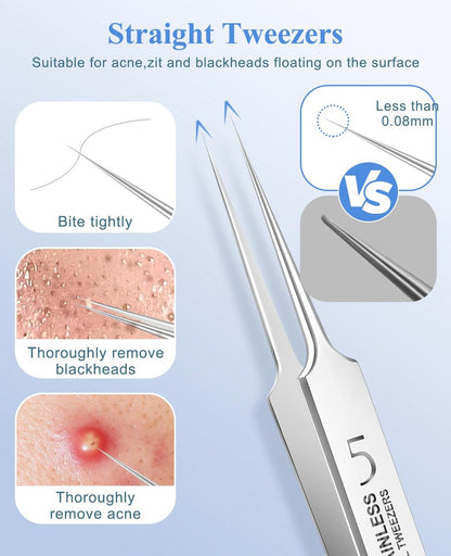 3-Piece Blackhead Remover Tweezers & Pimple Popper Tool Kit – Stainless Steel Extractor for Blemishes, Whiteheads, and Ingrown Hairs Avelisse
