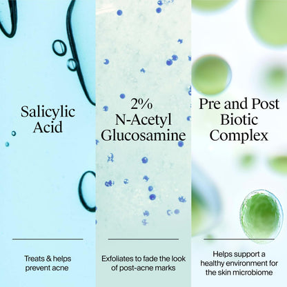 Neutrogena Evenly Clear Acne Gel Moisturizer with Salicylic Acid & N-Acetyl Glucosamine, Lightweight Non-Greasy Face Moisturizer for Acne-Prone Skin, 1.7 fl. oz
