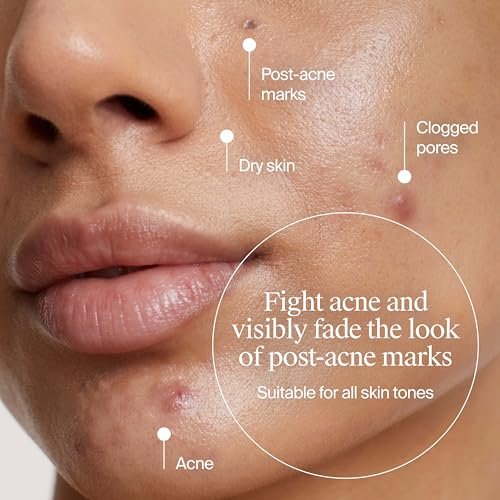 Neutrogena Evenly Clear Acne Gel Moisturizer with Salicylic Acid & N-Acetyl Glucosamine, Lightweight Non-Greasy Face Moisturizer for Acne-Prone Skin, 1.7 fl. oz - görsel 6