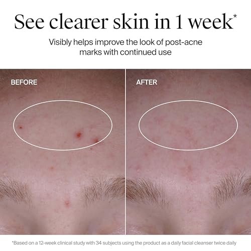 Neutrogena Evenly Clear Acne Cleanser with 2% Salicylic Acid & 2% PHA Exfoliant, Gentle Foaming Face Wash for Clogged Pores, Blackheads & Post-Acne Marks, 9.1 fl. oz - görsel 12