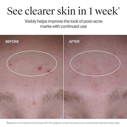 Neutrogena Evenly Clear Acne Cleanser with 2% Salicylic Acid & 2% PHA Exfoliant, Gentle Foaming Face Wash for Clogged Pores, Blackheads & Post-Acne Marks, 9.1 fl. oz