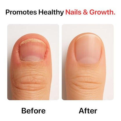 C CARE Nail Biting Prevention for Kids & Adults - Safe, Bitter, Clear, Thumb Sucking Deterrent | Stop Nail Biting Treatment, Fast Drying, Easy Brush On, 0.5 fl oz