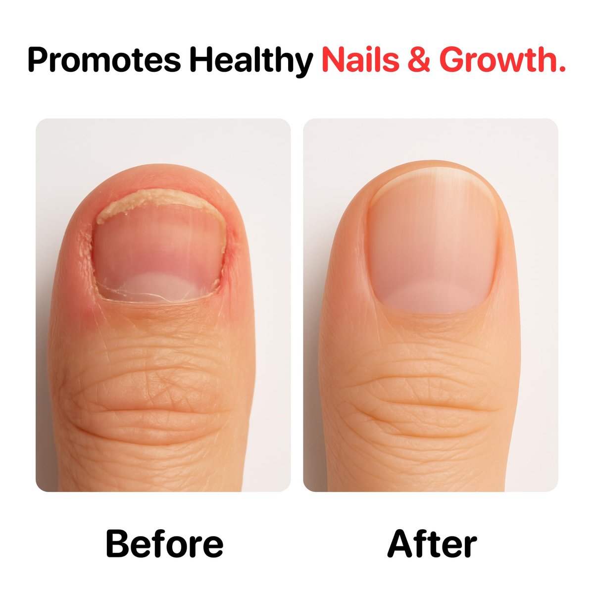 C CARE Nail Biting Prevention for Kids & Adults - Safe, Bitter, Clear, Thumb Sucking Deterrent | Stop Nail Biting Treatment, Fast Drying, Easy Brush On, 0.5 fl oz - görsel 11