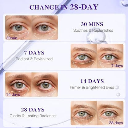 ICIKOL Grape Seed Collagen Under Eye Patches – Hydrating Eye Mask for Puffy Eyes, Dark Circles & Eye Bags (12 Pairs)