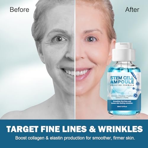 Stem Cell Serum for Face – 2 Pack Microneedling Serum Ampoule Booster for Anti-Aging, Wrinkles, Scars, Hydration & Rejuvenation, 1 fl oz Each Avelisse