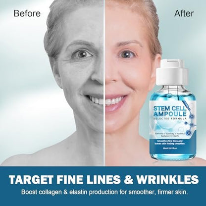 Stem Cell Serum for Face – 2 Pack Microneedling Serum Ampoule Booster for Anti-Aging, Wrinkles, Scars, Hydration & Rejuvenation, 1 fl oz Each Avelisse