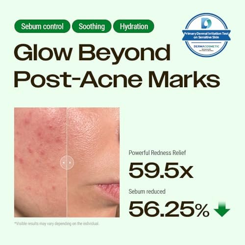 YUMU Cica Exosome Zinc Blemish Relief Cream - Face Moisturizer for Sensitive, Acne-Prone Skin - Lightweight, Oil-Free, Barrier Repair & Hydration - Korean Skincare (80 ml/2.70 fl.oz.) Avelisse