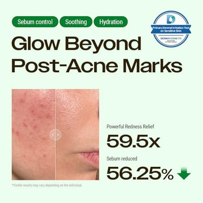 YUMU Cica Exosome Zinc Blemish Relief Cream - Face Moisturizer for Sensitive, Acne-Prone Skin - Lightweight, Oil-Free, Barrier Repair & Hydration - Korean Skincare (80 ml/2.70 fl.oz.) Avelisse