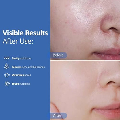 Hicream Glycolic Acid Pads – Dual-Textured Facial Exfoliating Toner for Pore Care & Skin Radiance, Deep Cleansing Peel with Niacinamide, Salicylic Acid & Vitamins E, B3, B5 (50 Pads)
