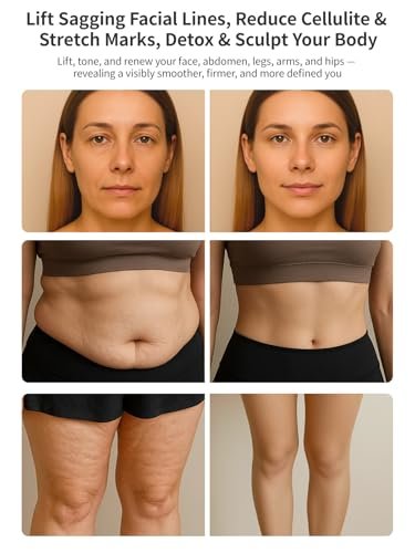 DiDEER 5-in-1 Body Sculpting Machine - Cellulite Removal & Lymphatic Drainage Massager for Face, Belly, Arms, Legs, Waist, Love Handles Avelisse