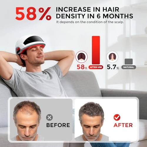 OVEKPA Red Light Therapy for Hair Growth Laser Cap - FDA Cleared Laser Therapy Device for Hair Regrowth, Alopecia Treatment for Men & Women (White) Avelisse