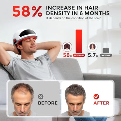OVEKPA Red Light Therapy for Hair Growth Laser Cap - FDA Cleared Laser Therapy Device for Hair Regrowth, Alopecia Treatment for Men & Women (White) Avelisse