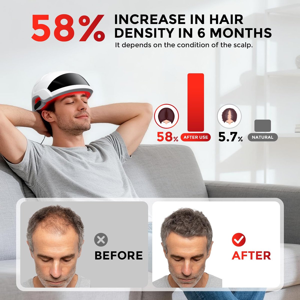 OVEKPA Red Light Therapy for Hair Growth Laser Cap - FDA Cleared Laser Therapy Device for Hair Regrowth, Alopecia Treatment for Men & Women (White) Avelisse