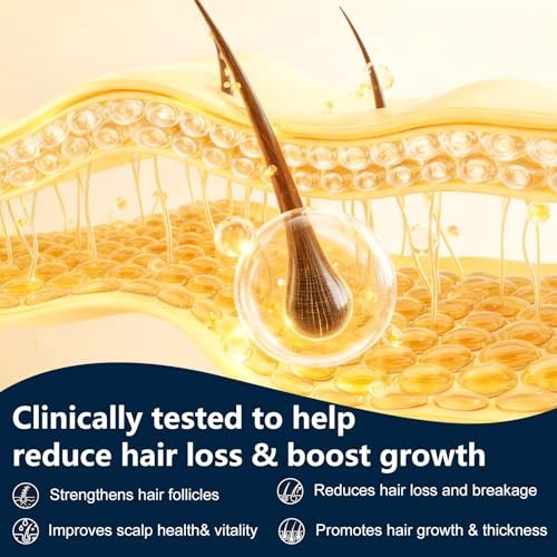 Miracle TQ Root Activator Shampoo for Men & Women - Anti Hair Loss & Hair Regrowth with Natural Herbal Ingredients & Biotin - Scalp Health & Cooling Sensation, 10.1 Fl Oz Avelisse