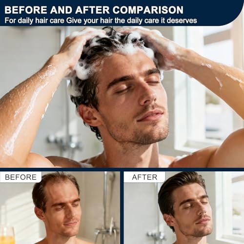 Miracle TQ Root Activator Shampoo for Men & Women - Anti Hair Loss & Hair Regrowth with Natural Herbal Ingredients & Biotin - Scalp Health & Cooling Sensation, 10.1 Fl Oz Avelisse