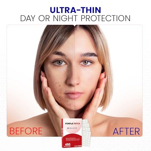 Hellados™ 450 Pimple Patches for Face – 4 Sizes Acne Patches with Tea Tree & Calendula Oil, Hydrocolloid Zit Patches & Blemish Spot Stickers - görsel 8