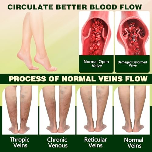 LHBMET Professional Leg Circulation Cream – Fluid Ease Leg Soothing Cream for Edema Relief, Reduce Leg Discomfort, 3.5 Fl Oz Avelisse