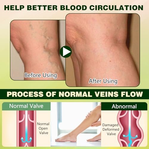 LHBMET Professional Leg Circulation Cream – Fluid Ease Leg Soothing Cream for Edema Relief, Reduce Leg Discomfort, 3.5 Fl Oz Avelisse