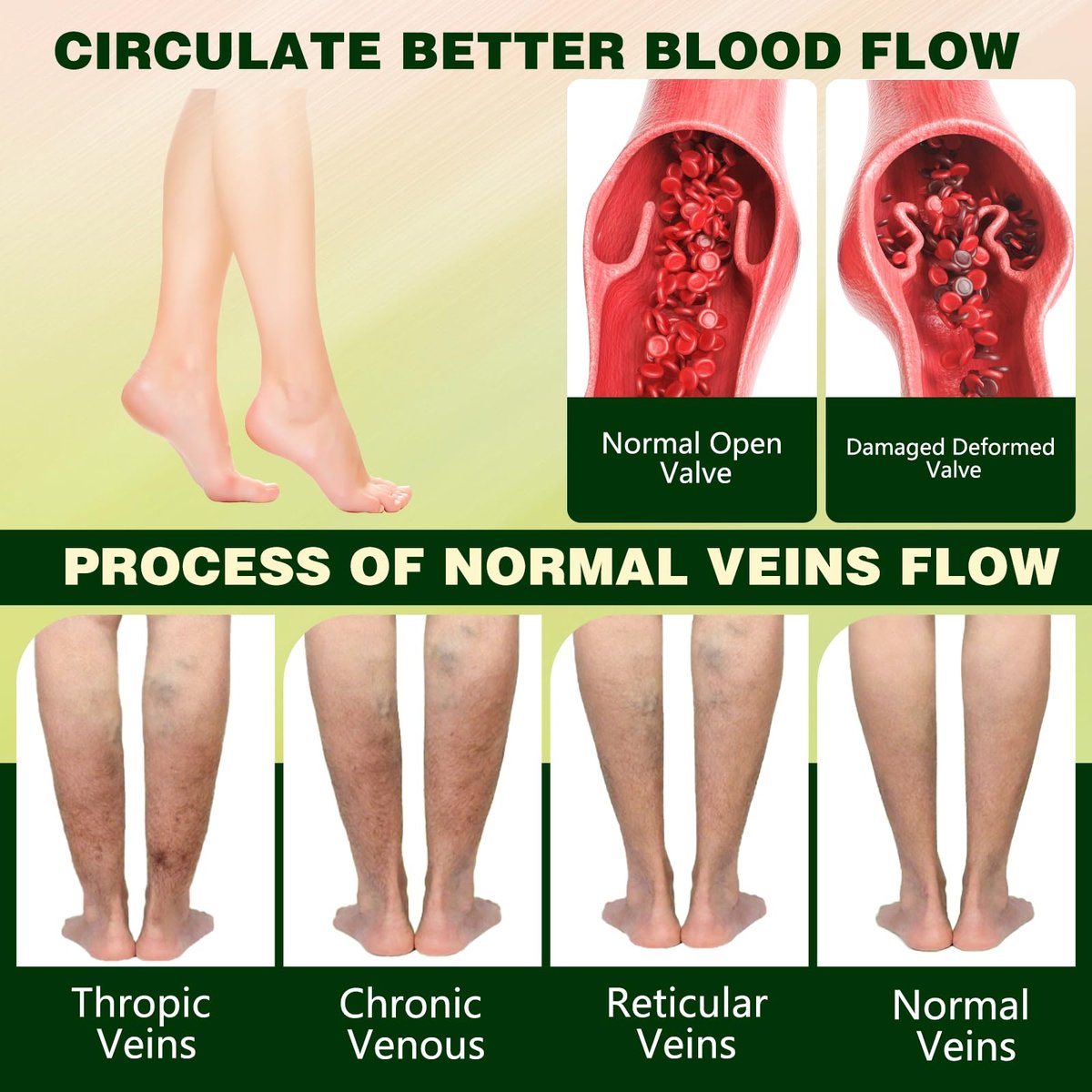 LHBMET Professional Leg Circulation Cream – Fluid Ease Leg Soothing Cream for Edema Relief, Reduce Leg Discomfort, 3.5 Fl Oz Avelisse