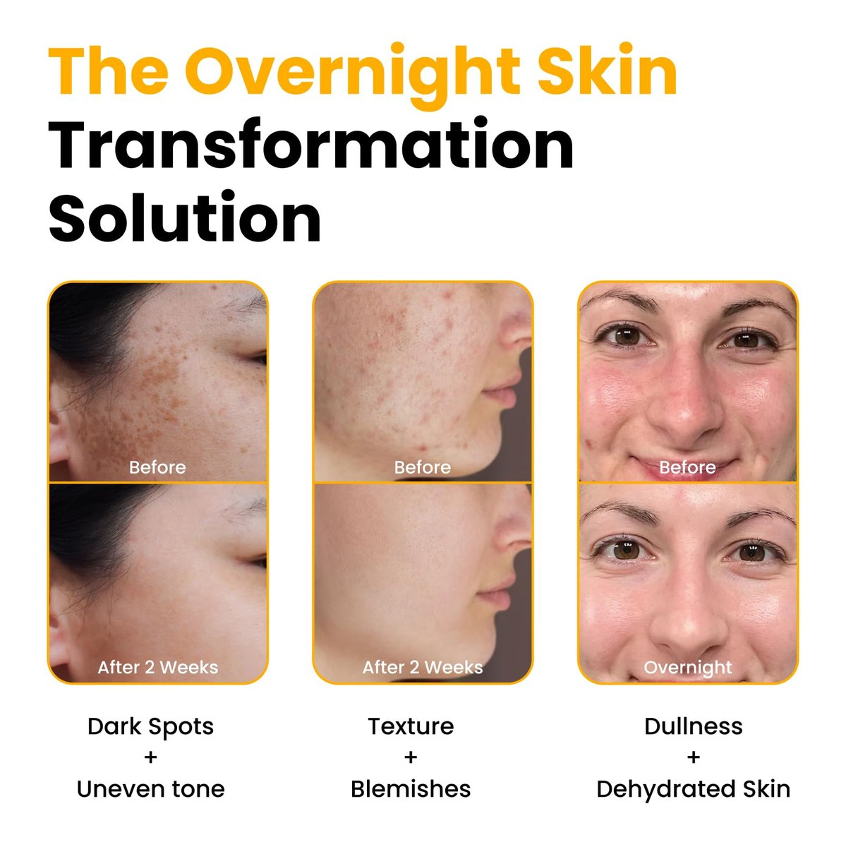 QUIA Turmeric + Kojic Acid Overnight Wrapping Mask – Hydrating Korean Face Mask for Glowing Skin, Even Tone & Improved Texture, 2.53 Fl Oz Avelisse