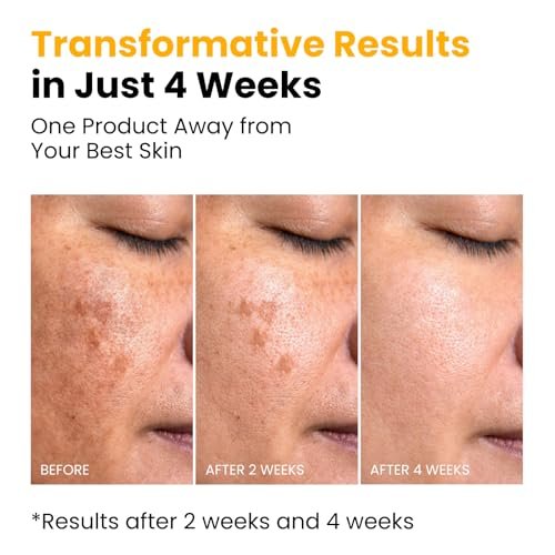 QUIA Turmeric + Kojic Acid Overnight Wrapping Mask – Hydrating Korean Face Mask for Glowing Skin, Even Tone & Improved Texture, 2.53 Fl Oz Avelisse