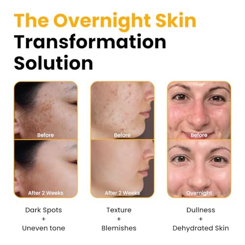QUIA Turmeric + Kojic Acid Overnight Wrapping Mask – Hydrating Korean Face Mask for Glowing Skin, Even Tone & Improved Texture, 2.53 Fl Oz Avelisse