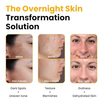 QUIA Turmeric + Kojic Acid Overnight Wrapping Mask – Hydrating Korean Face Mask for Glowing Skin, Even Tone & Improved Texture, 2.53 Fl Oz Avelisse