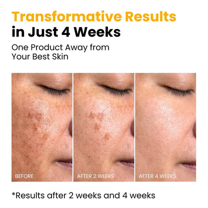 QUIA Turmeric + Kojic Acid Overnight Wrapping Mask – Hydrating Korean Face Mask for Glowing Skin, Even Tone & Improved Texture, 2.53 Fl Oz Avelisse