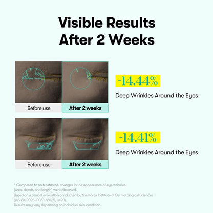 VT COSMETICS PDRN Reedle Shot Firming Eye Cream – Ultra-Micro Vibration Eye Cream for Firming & Elasticity, Targeted Wrinkle Care, PDRN Collagen, Korean Skincare (0.51 fl oz / 15ml) Avelisse