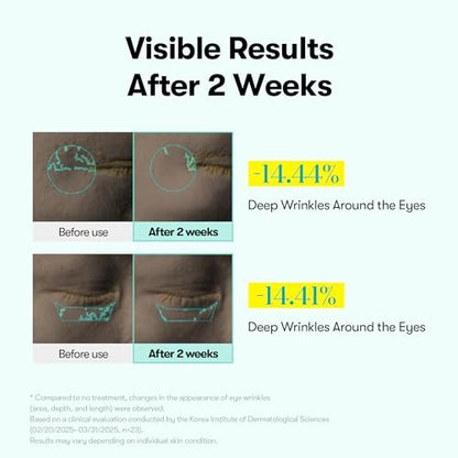 VT COSMETICS PDRN Reedle Shot Firming Eye Cream – Ultra-Micro Vibration Eye Cream for Firming & Elasticity, Targeted Wrinkle Care, PDRN Collagen, Korean Skincare (0.51 fl oz / 15ml) Avelisse