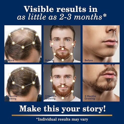 5% Minoxidil Hair Growth for Men and Women: Extra Strength Topical Solution with Biotin - Regrowth Serum for Beard and Scalp, 2-Pack