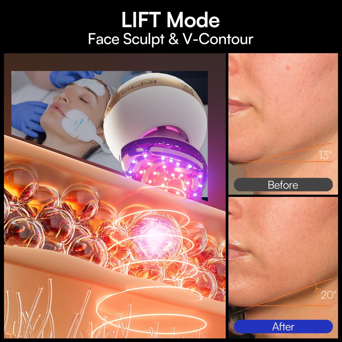 INIA SPHERA Upgraded 8-in-1 Microcurrent Facial Device for Face & Neck – Red Light, Thermal & Cooling Beauty Tool, 5 Custom Modes, At-Home Skin Stimulation & Glow Care Skincare Tool Avelisse