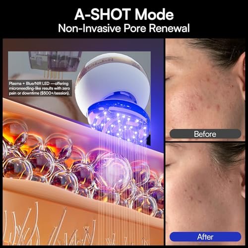 INIA SPHERA Upgraded 8-in-1 Microcurrent Facial Device for Face & Neck – Red Light, Thermal & Cooling Beauty Tool, 5 Custom Modes, At-Home Skin Stimulation & Glow Care Skincare Tool Avelisse