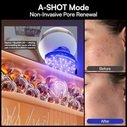 INIA SPHERA Upgraded 8-in-1 Microcurrent Facial Device for Face & Neck – Red Light, Thermal & Cooling Beauty Tool, 5 Custom Modes, At-Home Skin Stimulation & Glow Care Skincare Tool Avelisse