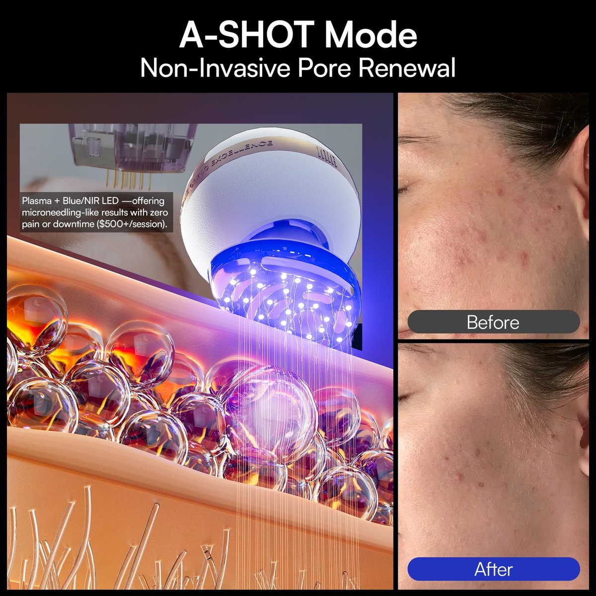 INIA SPHERA Upgraded 8-in-1 Microcurrent Facial Device for Face & Neck – Red Light, Thermal & Cooling Beauty Tool, 5 Custom Modes, At-Home Skin Stimulation & Glow Care Skincare Tool Avelisse