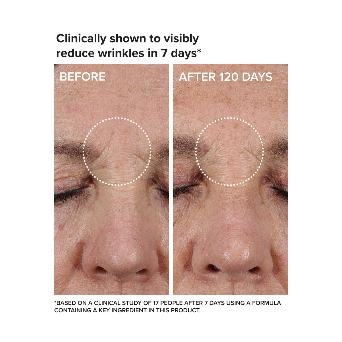 DRMTLGY Needle-less Growth Factor Serum for Face – Multi-Peptide & Hyaluronic Acid Firming and Lifting Serum, Skin Barrier Support & Wrinkle Care, 1 Fl Oz Avelisse