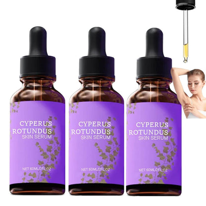 LOYOTICE 3-Pack Cyperus Rotundus Skin Serum – Natural Oil for Hair Removal, Moisturizing & Soothing Body Oil, Balances Skin Tone, Reduces Body Hair Avelisse
