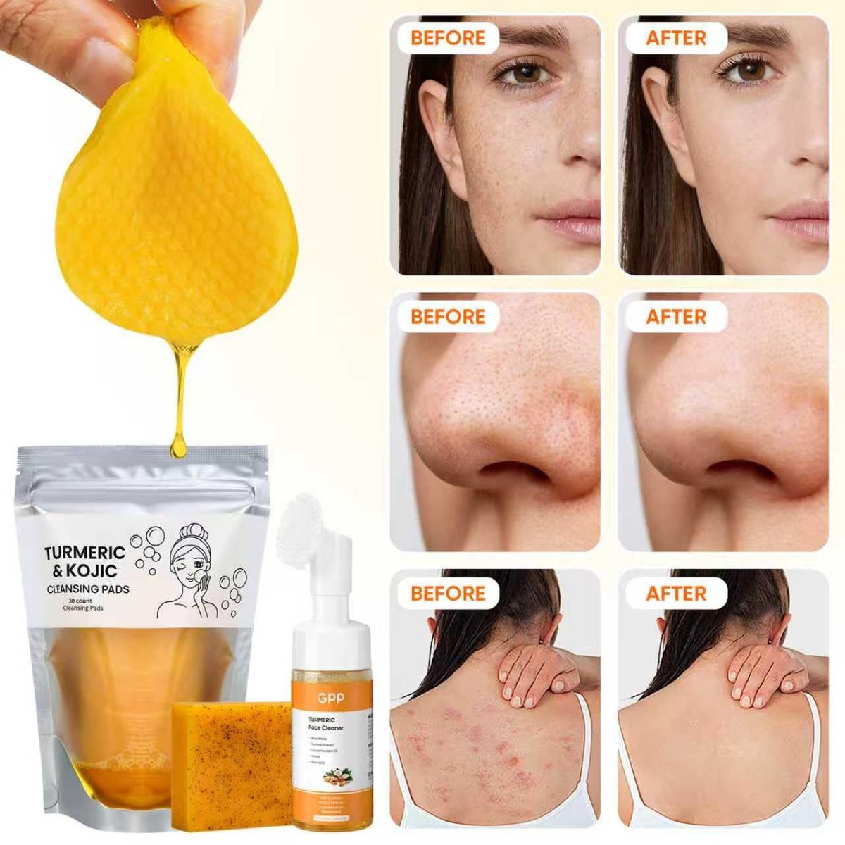 Turmeric Glow Skin Care Set: Soap, Face Wash & Cleansing Pads (30 Pads) for Radiant Skin Avelisse