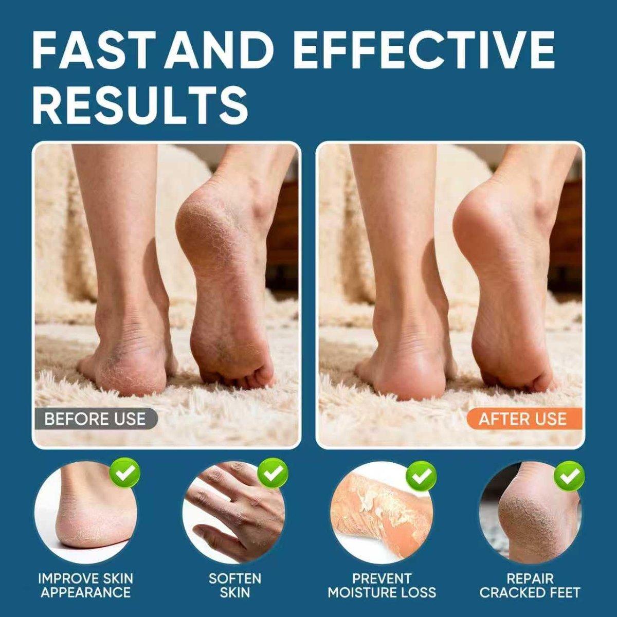 VREKEF Urea Cream 60% Plus Salicylic Acid 2% - Maximum Strength Foot Cream for Dry Heels and Cracked Skin, 5.29 oz Avelisse