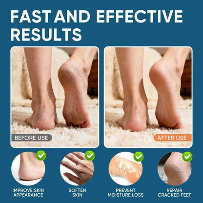 VREKEF Urea Cream 60% Plus Salicylic Acid 2% - Maximum Strength Foot Cream for Dry Heels and Cracked Skin, 5.29 oz Avelisse