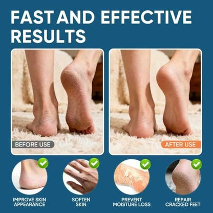 VREKEF Urea Cream 60% Plus Salicylic Acid 2% - Maximum Strength Foot Cream for Dry Heels and Cracked Skin, 5.29 oz Avelisse