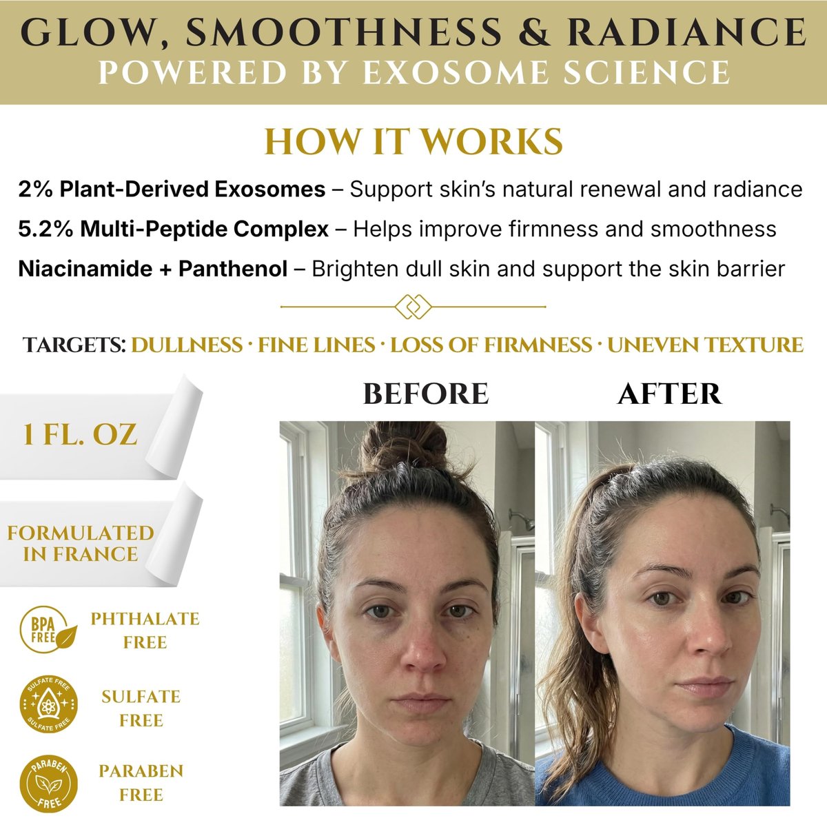 Exosomes for Skin Serum – Anti-Aging Multi Peptide Serum for Face Pores, Fine Lines & Microneedling – 2% Exosomes, GHK-Cu Copper Peptides, Argireline, EGF & Hyaluronic Acid Avelisse
