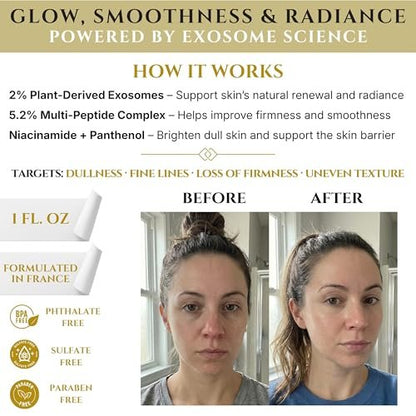 Exosomes for Skin Serum – Anti-Aging Multi Peptide Serum for Face Pores, Fine Lines & Microneedling – 2% Exosomes, GHK-Cu Copper Peptides, Argireline, EGF & Hyaluronic Acid Avelisse